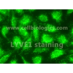 Human Primary Lymphatic Endothelial Cells
